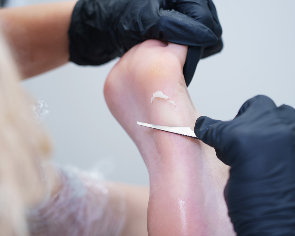 韓国式足裏角質ケアの施術イメージ